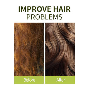 Huile Essentielle de Romarin et Menthe OEM pour Soin du Cuir Chevelu et Nutrition des Racines Capillaires, Arôme Rafraîchissant pour Renforcer et Lisser les Cheveux - Product Image 4
