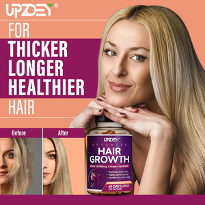 Private Label vitamine per la crescita dei capelli per le donne biotina 10,000mcg <span class=keywords><strong>Collage</strong></span> Saw Palmetto naturalmente più forte e più sano capelli pelle unghie - Product Image 2