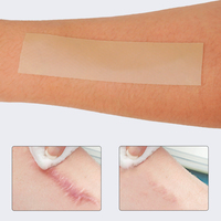 Patch cicatriciel en silicone pour le traitement des cicatrices Bandes de cicatrices réutilisables pour la chirurgie, la section C, les vergetures chéloïdes, l'élimination des cicatrices d'acné