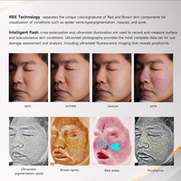 Escáner Facial Profesional con Detección de Luz UV y Función de Simulación de la Edad de la Piel