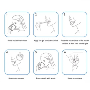 Kit de Blanqueamiento Dental Eléctrico Portátil en Forma de U para Uso Doméstico, Blanqueador Dental Recargable por USB - Product Image 5