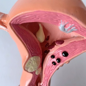 Modelo de Útero Femenino de Alta Calidad, Modelo de Útero Fantómico - Product Image 4