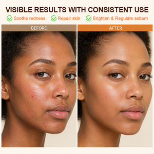 เซรั่มบำรุงผิวหน้า Rooibos Tea Repair Serum สารต้านอนุมูลอิสระ ปลอบประโลมผิว ผลิตภัณฑ์ดูแลผิว OEM แบรนด์ส่วนตัว - Product Image 3