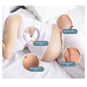 OEM 1KG Crème pour le corps <span class=keywords><strong>anti</strong></span>-<span class=keywords><strong>vergeture</strong></span> à base de plantes pour raffermir la peau Élimination des vergetures <span class=keywords><strong>Grossesse</strong></span> Ingrédient principal Beurre de karité biologique - Product Image 4