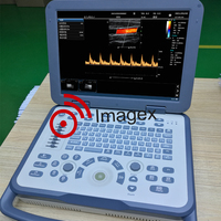 Machine à ultrasons Doppler couleur pour ordinateur portable portable pour usage humain et vétérinaire