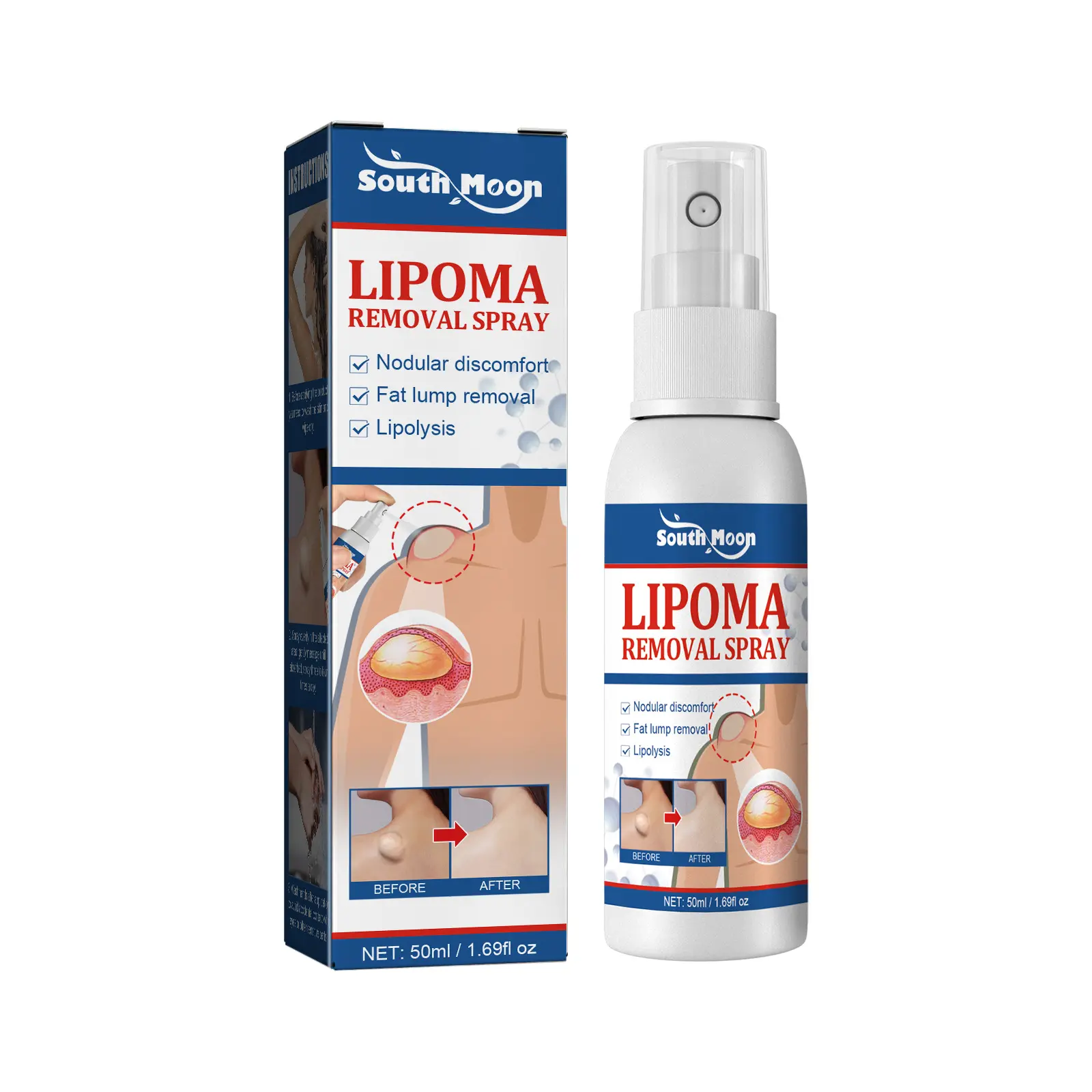 Spray de remoção de lipoma OEM/ODM 50ML para celulite, tratamento de gordura, massagem, cuidados com medicamentos