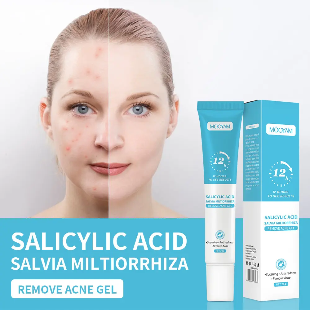 Atacado Calmante Anti Vermelhidão Ácido Salicílico Acne Remoção Gel Oil Control Pimple Remover Creme Para Cuidados Com A Pele