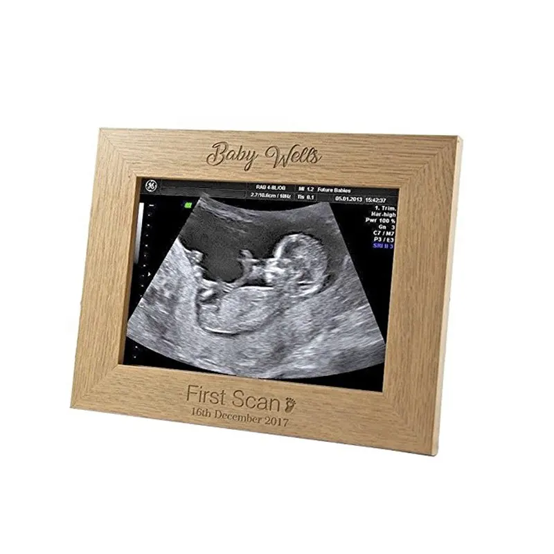 Gedenkteken Aandenken 5x7 inch Fotolijst Scan Gegraveerd Houten Baby Scan Fotolijst Voor Nieuwe Baby Gift