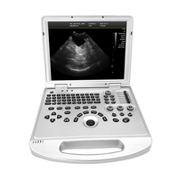 Sistema de Ultrasonido Doppler Color Veterinario Multiprobes para Imágenes de Animales, para Perros, Gatos, Caballos y Ganado
