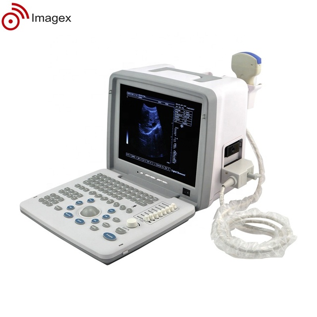 PUS1 Max Portable Ultrasound Machine with Advanced Digital Imaging for Veterinary Medical Diagnosis
