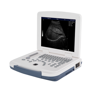 12.1 inch Dawei DW-580 đầy đủ kỹ thuật số siêu âm chẩn đoán cầm tay máy siêu âm Mindray máy siêu âm - Product Image 1