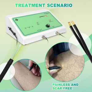 Terbaik 2 in 1 paduan Electrolyze Tweezer profesional pigmen penghapusan terisolasi jarum elektrolisis untuk menghilangkan rambut - Product Image 3