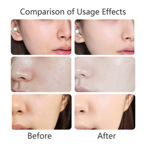 <span class=keywords><strong>Crème</strong></span> Visage Éclaircissante et Hydratante au Ginseng et Vitamine C Anti-Teint Terne pour Teint Irrégulier et Soin des Rides Fines – Offre Spéciale - Product Image 4