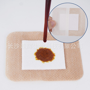 Apósito Médico Estéril Impermeable Transpirable de Talla Grande Changsha Lianhui para Cuidado Postoperatorio de Heridas Quirúrgicas - Product Image 1