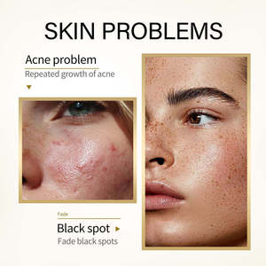 Kit de Soins Végétaliens Éclaircissants au Curcuma avec Niacinamide et Vitamine E – Nettoyant Pores et Anti-Acné pour Teint Irrégulier et Marque Privée - Product Image 3