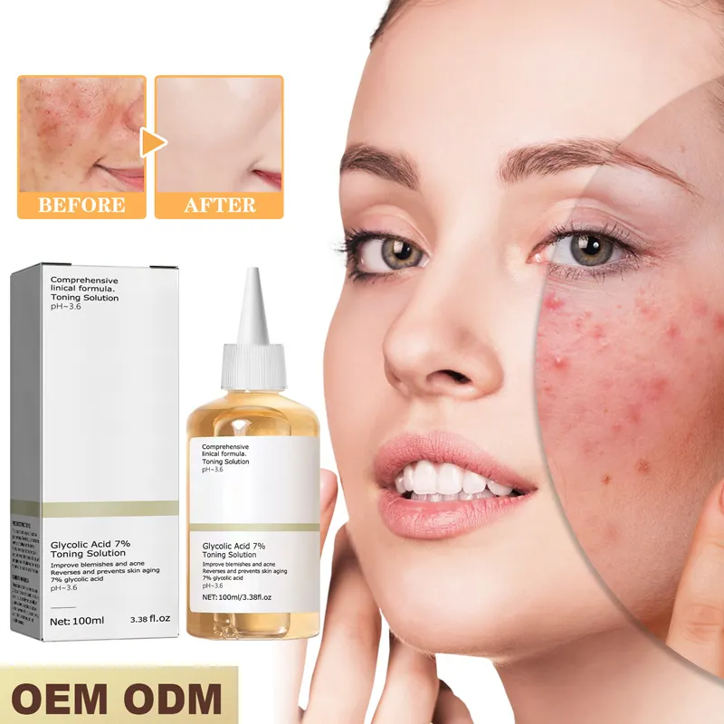 Tùy chỉnh axit glycolic 7% Toning Giải pháp chăm sóc da giai điệu Glycolic