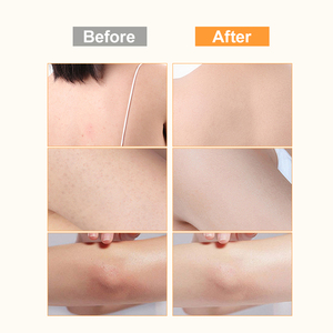 Gel Douche Moussant Hydratant et Nourrissant au Melon Frais avec Logo Personnalisé – Nettoyant Corporel Marque Privée pour Usage Quotidien - Product Image 4