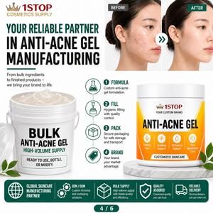Gel cicatrisant réparateur à action rapide pour cicatrices chirurgicales, peaux à tendance acnéique et marques de boutons, pour une peau lisse, à base de plantes, crème <span class=keywords><strong>anti</strong></span>-imperfections, ODM Soins de la peau - Product Image 2
