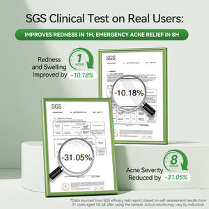 ランベナフェイシャルアンチアクネセラムナイアシンアミド + サリチル酸血清、無香料すべての肌タイプ、抗アクネユニセックス-大人10ml - Product Image 5