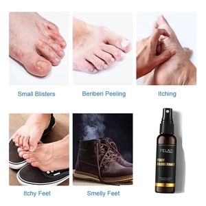 Nemesis Déodorant Produit de soin des pieds Parfum Spray d'élimination des odeurs de pieds pour adultes Artefacts Chaussures Chaussettes pour soins de la peau - Product Image 3
