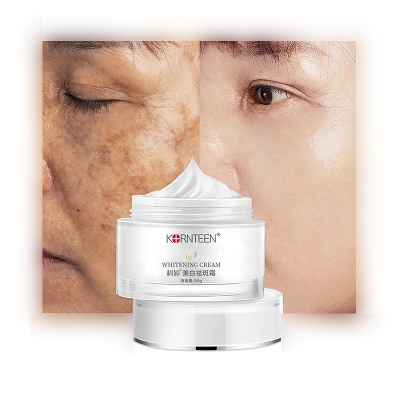 Сертифицированный никотинамид отбеливание меланодермия удаление темных пятен ластик лечение пигментации корректор для удаления веснушек пятна