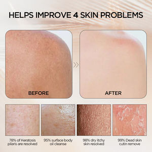 LaoTang Suministros de baño Hammam Ducha Baño Exfoliante corporal Guante Guantes exfoliantes mágicos Manopla para eliminar la piel muerta visiblemente - Product Image 3