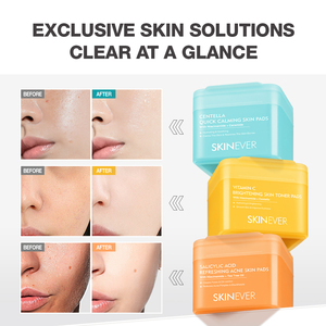 Tonique apaisant à la Centella Asiatica de haute qualité, formule coréenne SKINEVER, tampons <span class=keywords><strong>pour</strong></span> la <span class=keywords><strong>peau</strong></span>, apaisant <span class=keywords><strong>pour</strong></span> la <span class=keywords><strong>peau</strong></span>, adapté aux peaux sensibles - Product Image 6