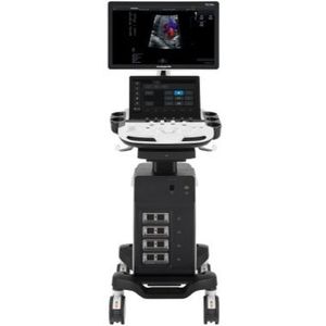 Sistema de Diagnóstico por Ultrasonido Doppler Digital de Alta Calidad Sonoscape P12 Elite con Imagen I+Scan para Humanos/Hospitales/Clínicas - Product Image 4