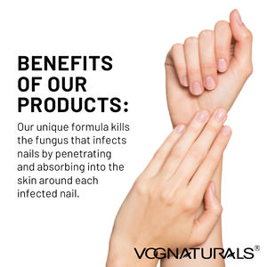 Crema rápida para eliminar <span class=keywords><strong>hongos</strong></span> en <span class=keywords><strong>las</strong></span> <span class=keywords><strong>uñas</strong></span> <span class=keywords><strong>de</strong></span> <span class=keywords><strong>los</strong></span> pies, restaura <span class=keywords><strong>las</strong></span> <span class=keywords><strong>uñas</strong></span> saludables, crema Natural, trata <span class=keywords><strong>los</strong></span> <span class=keywords><strong>hongos</strong></span> en <span class=keywords><strong>las</strong></span> <span class=keywords><strong>uñas</strong></span> sin efectos secundarios - Product Image 4