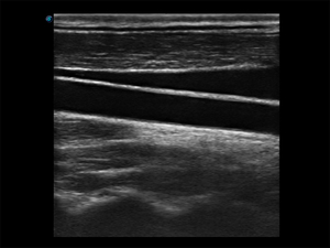 Escáner de Ultrasonido Veterinario <span class=keywords><strong>Sonoscape</strong></span> E1V <span class=keywords><strong>E1</strong></span> y Ultrasonido en Blanco y Negro para Uso Veterinario y Venta para Clínicas y Hospitales de Mascotas - Product Image 5