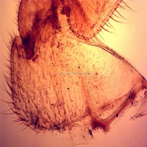 Lames de pathologie humaine de science médicale Offre Spéciale, ensemble de lames préparées au Microscope biologique de microscopie médicale - Product Image 4