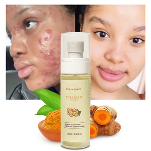 Correcteur organique de marque privée au curcuma atténue les imperfections <span class=keywords><strong>Toner</strong></span> pour le visage <span class=keywords><strong>Toner</strong></span> puissant et éclaircissant pour les taches brunes au curcuma - Product Image 1