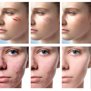 Crème réparatrice de cicatrices puissante la plus vendue pour une cicatrisation rapide des cicatrices du corps et des bras, douce et non irritante, prix de gros - Product Image 2