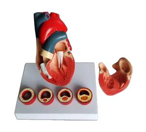 Model penyakit jantung erotis atherosclerotik koroner untuk pelatihan perawat Model penelitian sains medis manusia - Product Image 5