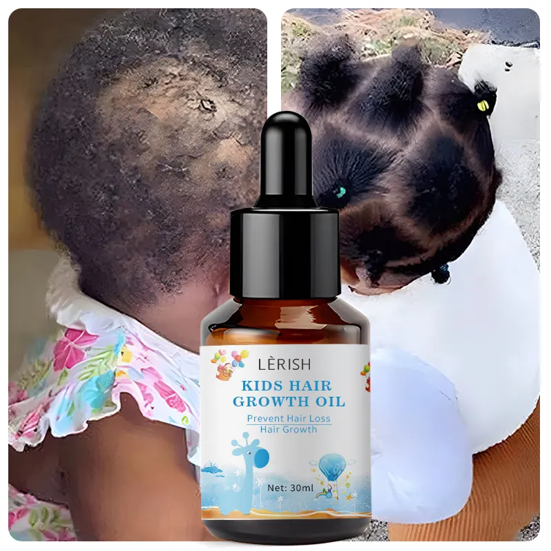 Productos naturales para el cuidado del cabello para bebés y niños con logotipo personalizado, aceite de suero de aceite para el crecimiento del cabello de bebé para niños con crecimiento y nutrición extra fuerte