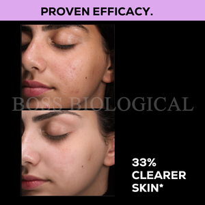 Personnalisation du sérum au curcuma à l'acide kojique Sérum à l'acide azélaïque Sérum éclaircissant pour les taches brunes <span class=keywords><strong>Correcteur</strong></span> de teint - Product Image 4