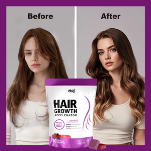 Productos de Belleza Antioxidantes para Adultos, Gomitas de Biotina y Vitamina C para el Crecimiento del Cabello, para Pedidos al por Mayor, Etiquetas Personalizadas - Product Image 4