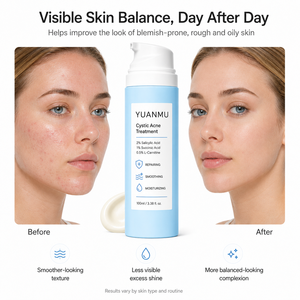 Anti-Akne Feuchtigkeitscreme Reduziert Rötungen Hautunreinheiten Pickel-Entferner Zystische Akne-Behandlungscreme für das Gesicht - Product Image 6