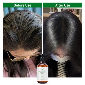 <span class=keywords><strong>Shampoing</strong></span> Marque Blanche Nettoyant en Profondeur Clarifiant Équilibrant Purifiant <span class=keywords><strong>Détoxifiant</strong></span> Volumisant Léger et Aérien pour Plus de Volume et le Contrôle du Sébum - Product Image 2
