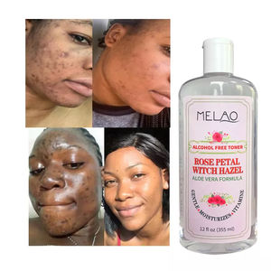 % 100% saf doğal organik cilt bakımı gül yaprağı cadı ela Toner su özel lekeleri karanlık noktalar akne sökücü için yüz - Product Image 1