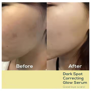 50ml Sản phẩm làm đẹp thủy phân collagen huyết thanh cho tất cả các loại da mặt giữ ẩm làm sáng đốm đen điều chỉnh - Product Image 2