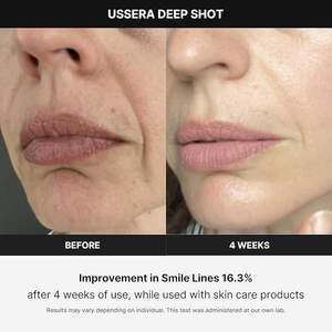 MEDICUBE AGE-R USSERA DEEP SHOT 176.4g - Masseur facial pour lifting à domicile avec prise EU - Appareil de beauté anti-âge coréen - Product Image 2