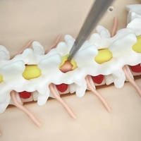Modèle de formation à la chirurgie endoscopique transforaminaire, modèle UBE, simulateur de formation à l'endoscopie transforaminaire