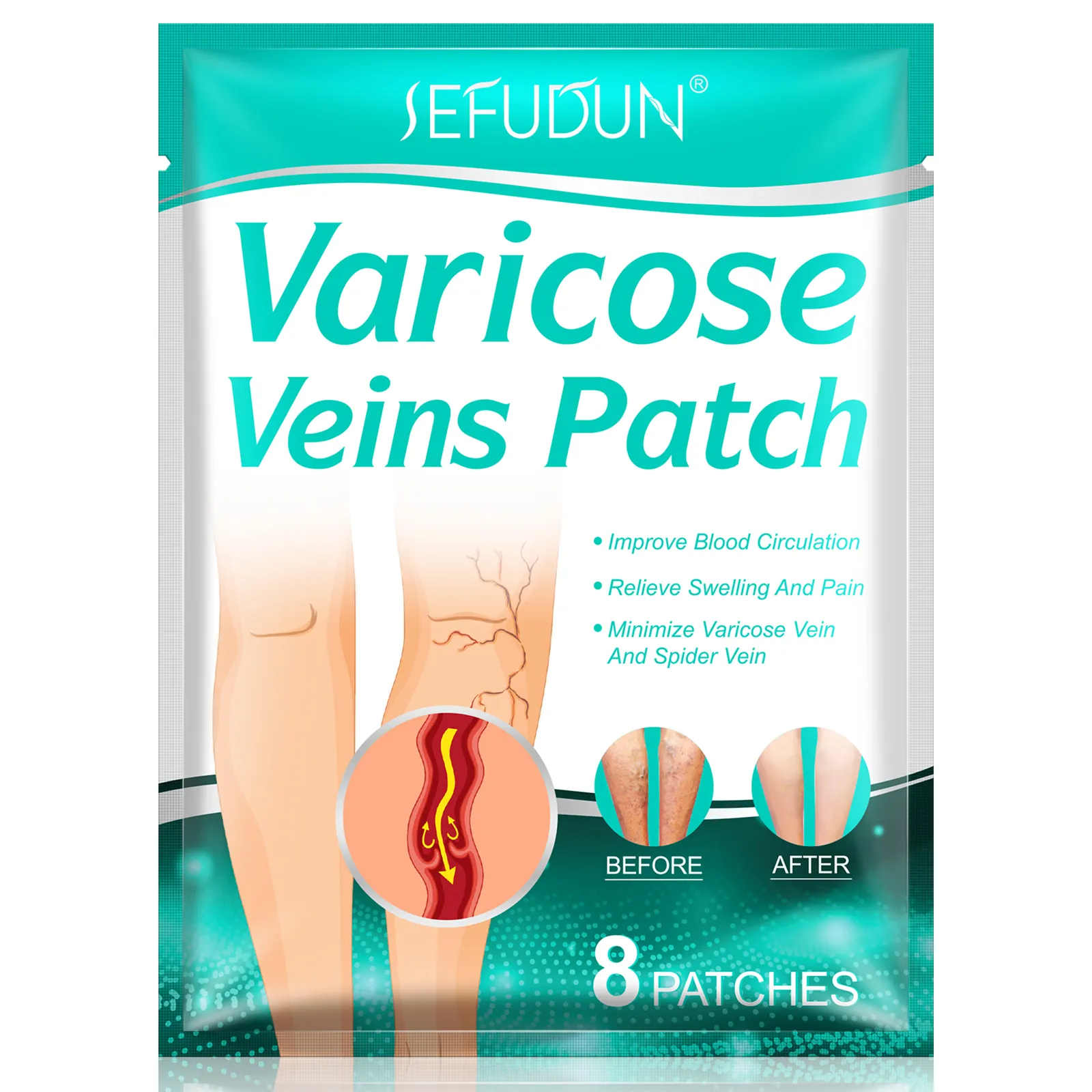 OEM vene Varicose Patch Relief dolore alle gambe rafforza la salute dei capillari migliora la circolazione sanguigna pasta per il trattamento delle vene Varicose