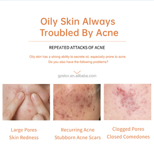 Crème Professionnelle Traitement Acné à Base de Plantes Réparation Rougeurs Efficace Estompe les Taches d'Acné Apaisement des Boutons Hydratant Soin Visage - Product Image 2