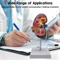 Reno normal y enfermo con perspectiva dual para patología, anatomía humana y educación CE/ISO