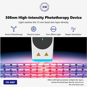 CN-308P1 308nm LED UVB Therapy Handheld Lithium Battery-Powered Easy Operation Mini Size for Vitiligo Psoriasis Treatment - Product Image 1