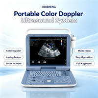 Ecógrafo Doppler Color Portátil con Pantalla LCD de 15 Pulgadas, 5 Modos de Imagen, 8 Sondas, 500GB DICOM, para Abdomen, Cardiaco, Obstetricia/Ginecología y Clínica
