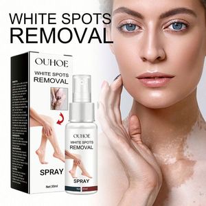 OUHOE Vente en gros 30ml Spray de traitement du vitiligo, anti-<span class=keywords><strong>taches</strong></span> <span class=keywords><strong>blanches</strong></span>, teigne, leucoplasie cutanée, dermatite - Product Image 3