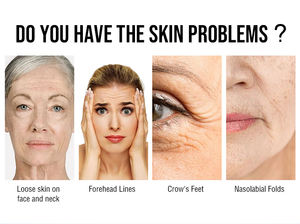 2025 Nova Huamei 1470nm Diodo <span class=keywords><strong>Laser</strong></span> Reparação Facial <span class=keywords><strong>Laser</strong></span> Remoção de Rugas <span class=keywords><strong>Stretch</strong></span> <span class=keywords><strong>Mark</strong></span> Rugas Abdominal Beleza Face Lift Machine - Product Image 3